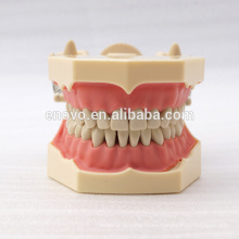 32 piezas de dientes extraíbles SF tipo modelo de estudio dental para la educación escolar 13009